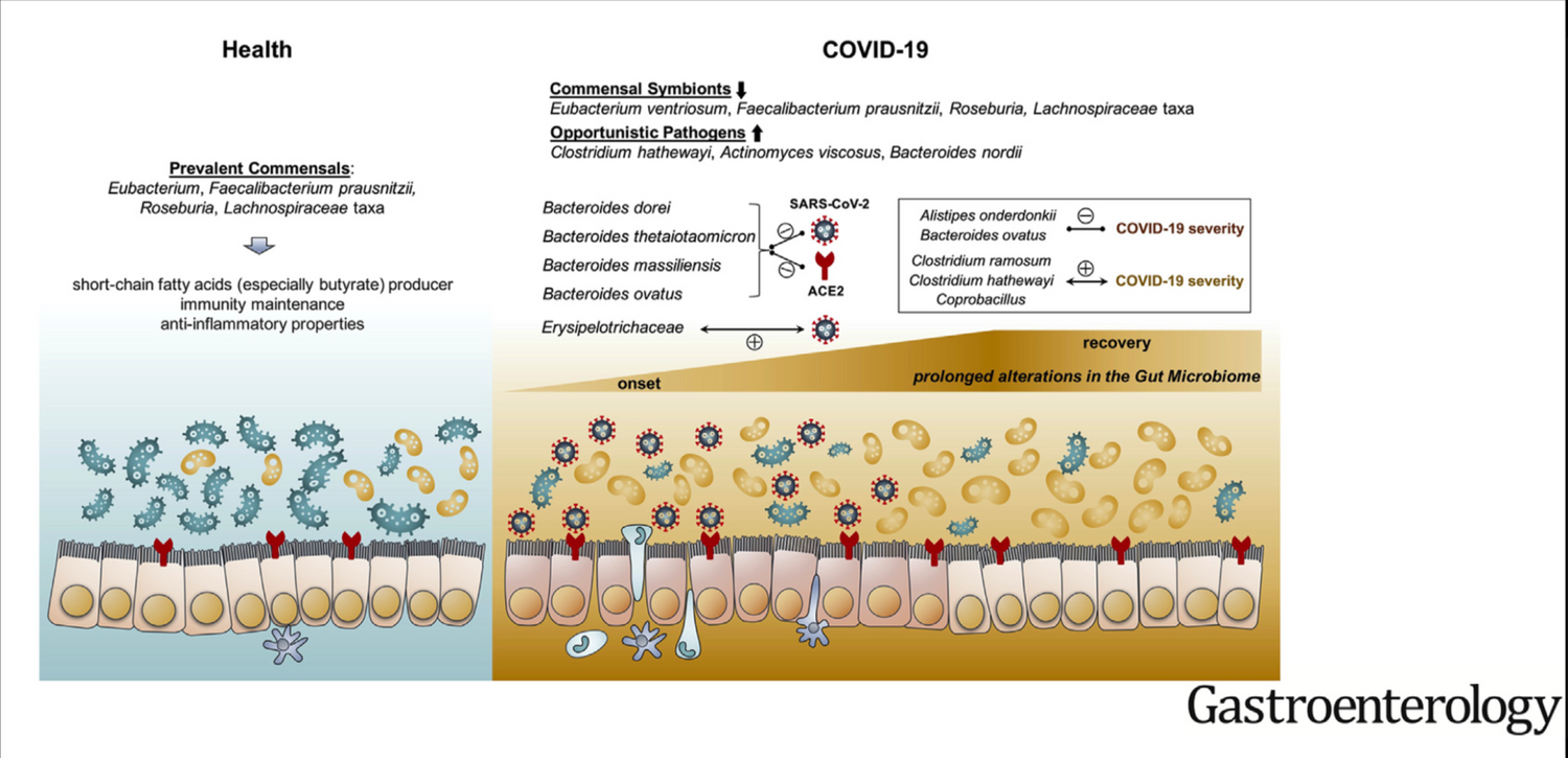 Gut Bacterial Alterations in COVID-19